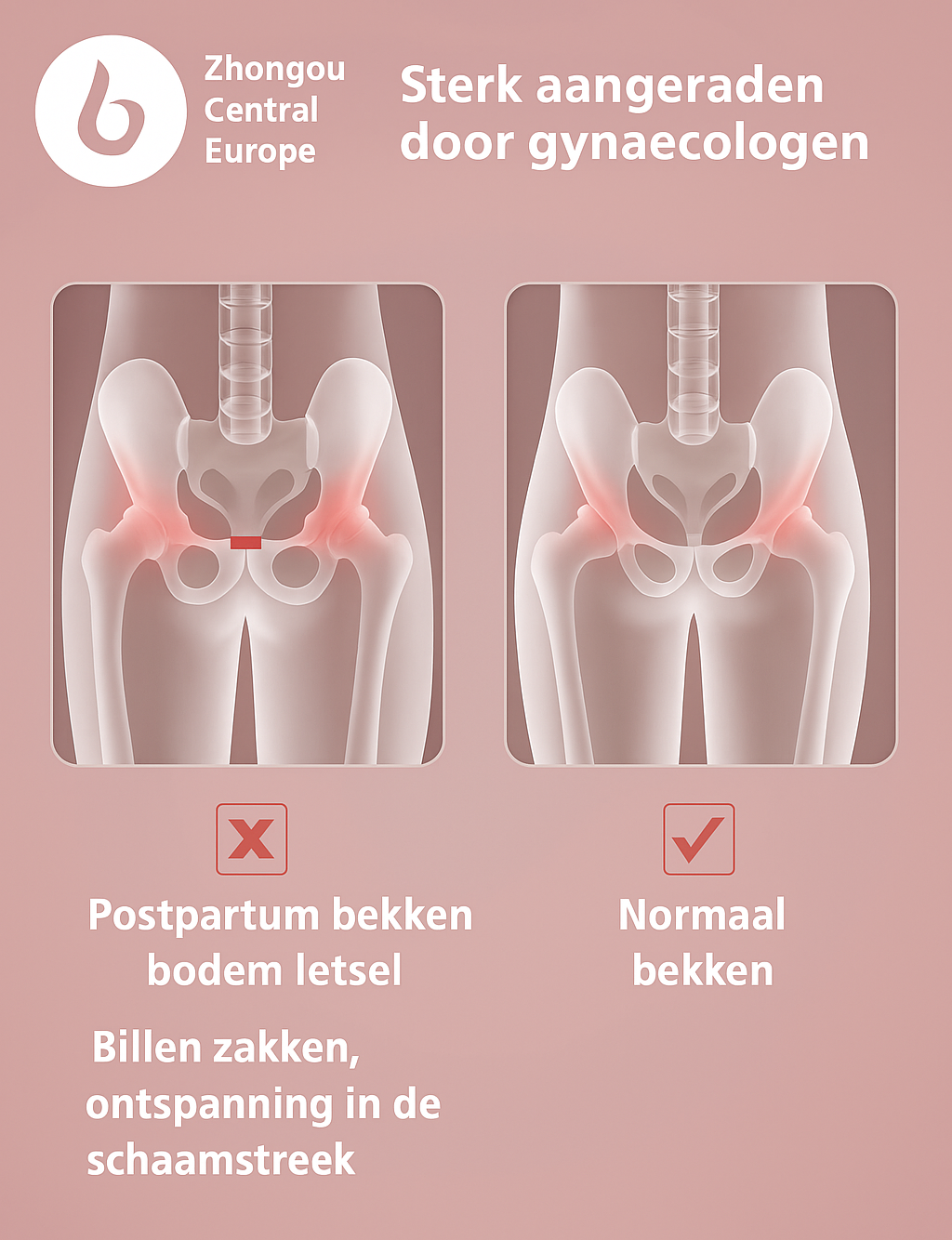 CoreFit™ Bekkenbodem Trainer – Slimme Kegel Trainer met App & Biofeedback